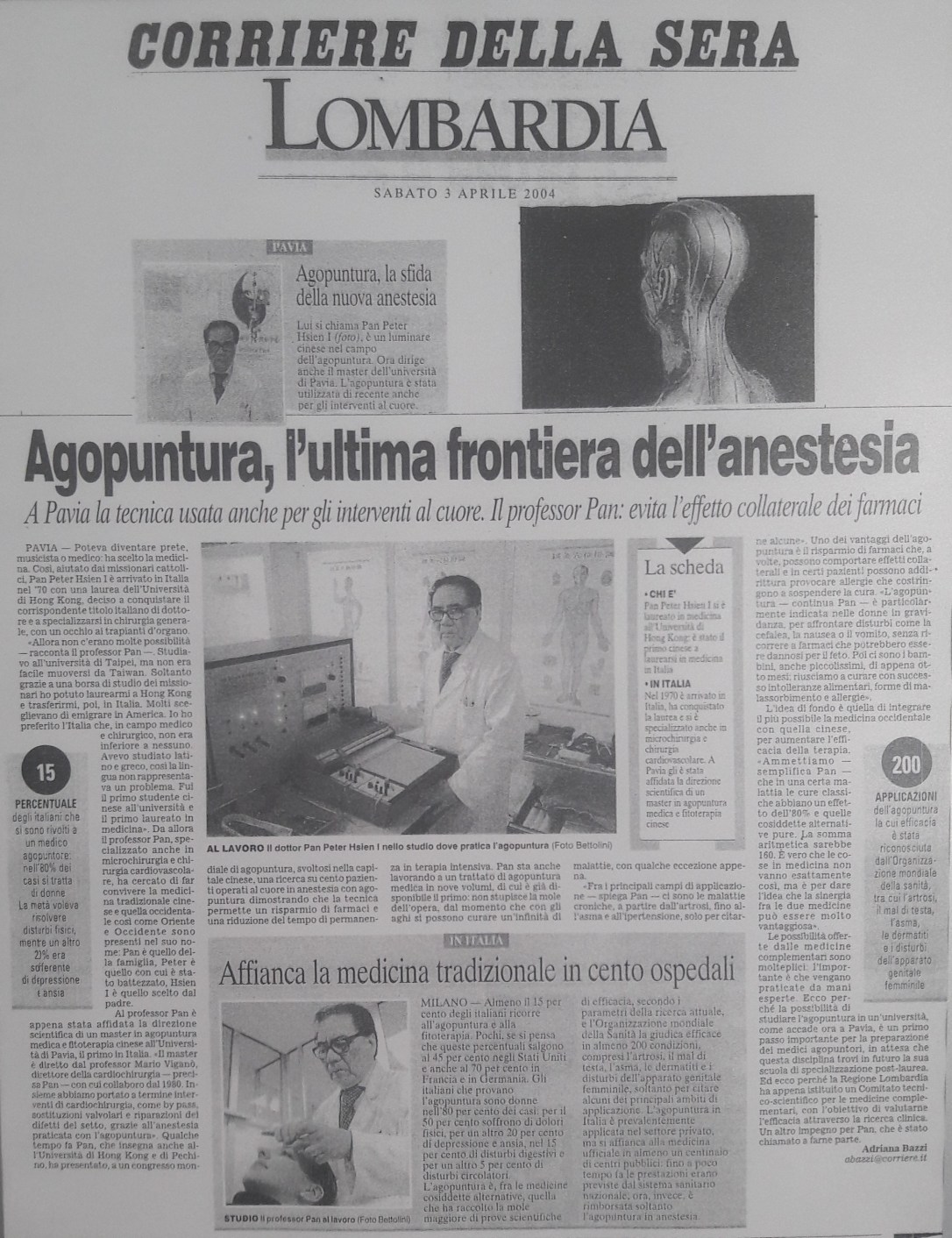 Agopuntura, l'ultima frontiera dell'anestesia